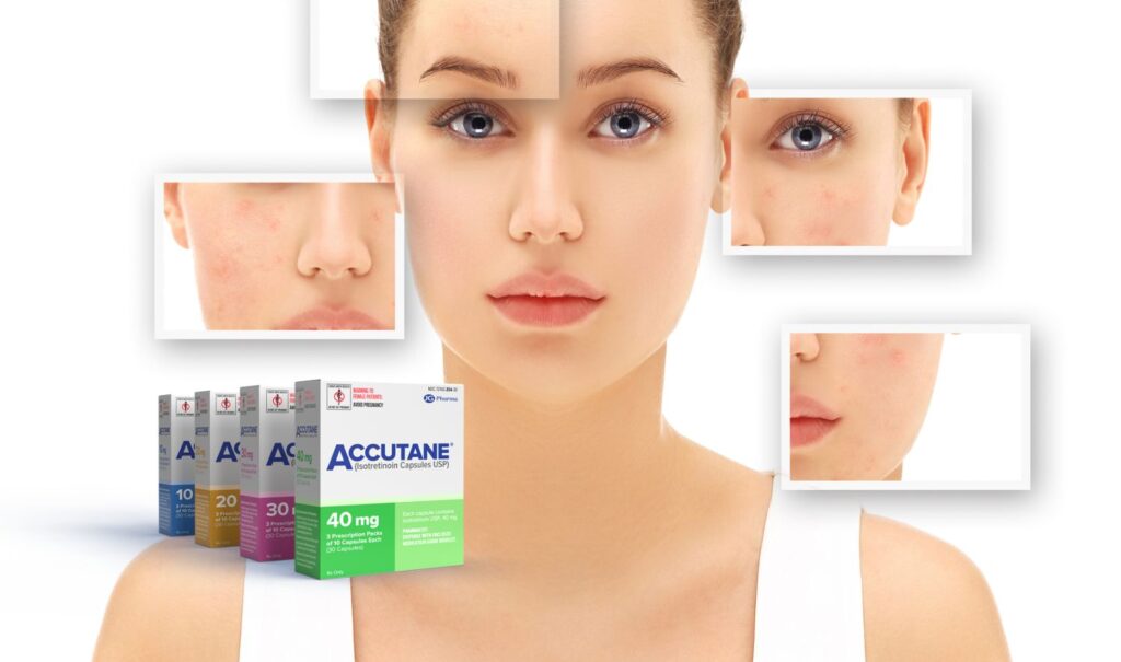 How to Minimize Accutane Side Effects