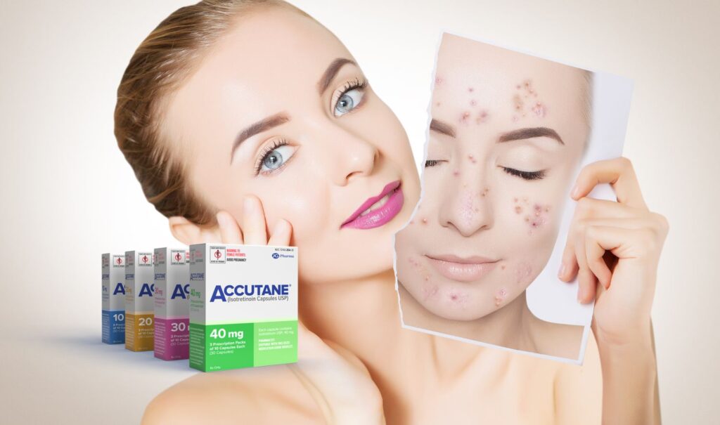 Everything You Need to Know About Accutane