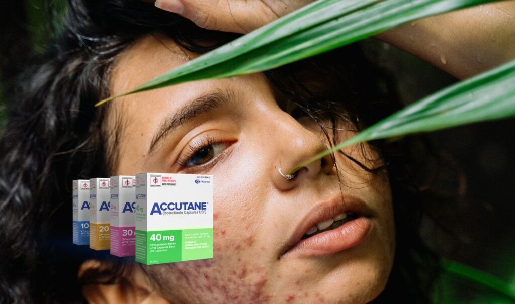 Long-Term Side Effects of Accutane: What You Should Know
