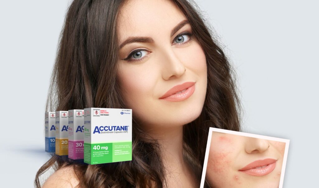 Accutane and Digestive Issues: Common Concerns