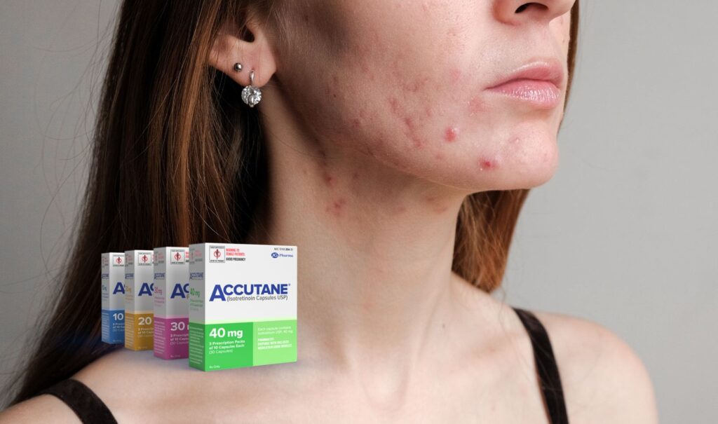 Accutane Myths and Facts: Debunking Common Misconceptions