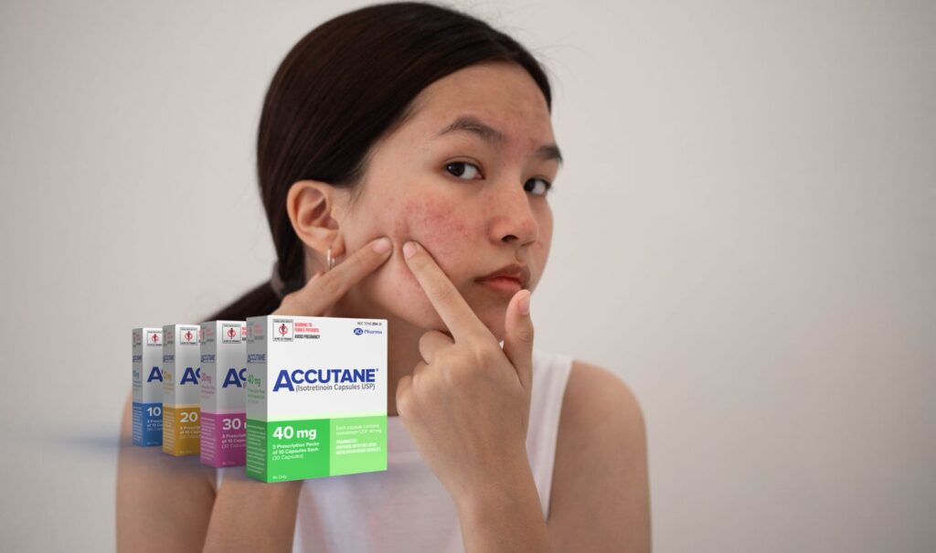 History of Accutane: From Discovery to Modern Use